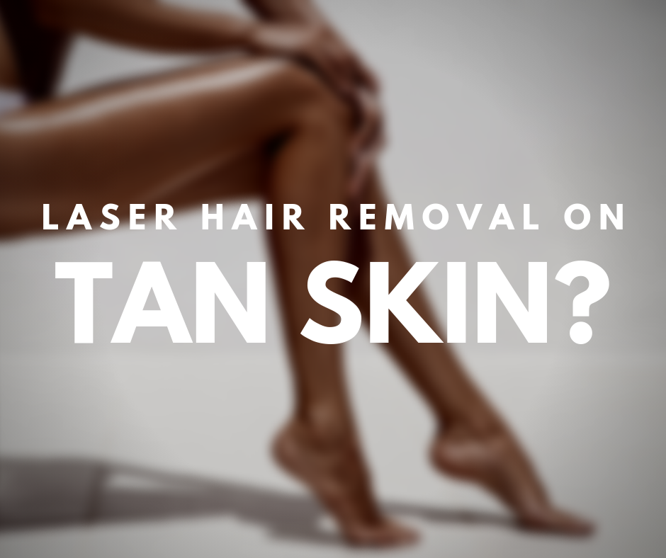 laser-hair-removal-does-it-work-on-tan-skin